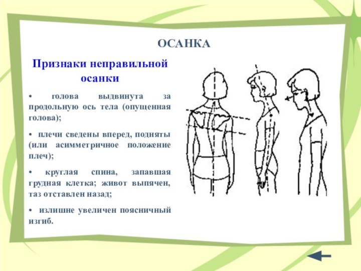 ОСАНКАПризнаки неправильной осанки• голова выдвинута за продольную ось тела (опущенная голова);• плечи