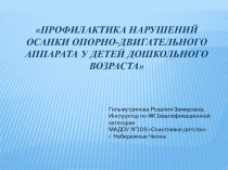 ПРОФИЛАКТИКА НАРУШЕНИЙ ОСАНКИ ОПОРНО-ДВИГАТЕЛЬНОГО АППАРАТА У ДЕТЕЙ ДОШКОЛЬНОГО ВОЗРАСТА презентация