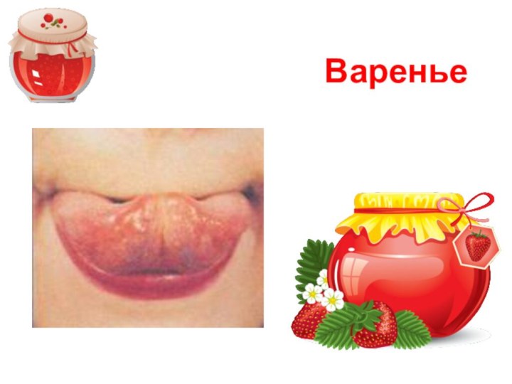 Варенье