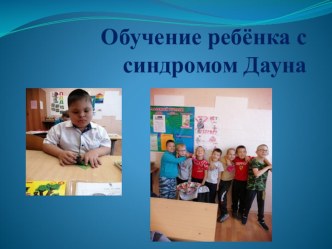 Особенности психического развития и обучения детей с синдромом Дауна. методическая разработка