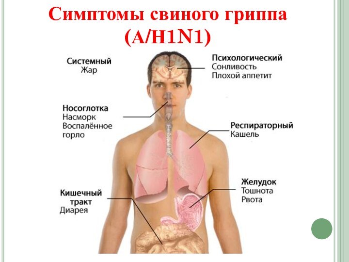 Симптомы свиного гриппа (А/Н1N1)