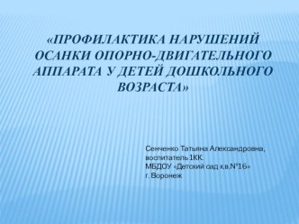 Профилактика нарушения осанки опорно-двигательного аппарата у детей дошкольного возраста презентация к уроку (подготовительная группа)