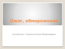 ожог. обморожение презентация к уроку по теме