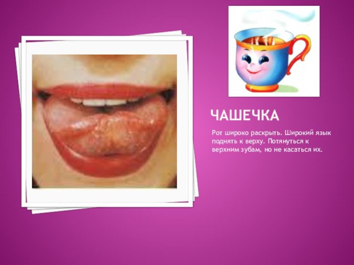 ЧАШЕЧКАРот широко раскрыть. Широкий язык поднять к верху. Потянуться к верхним зубам,