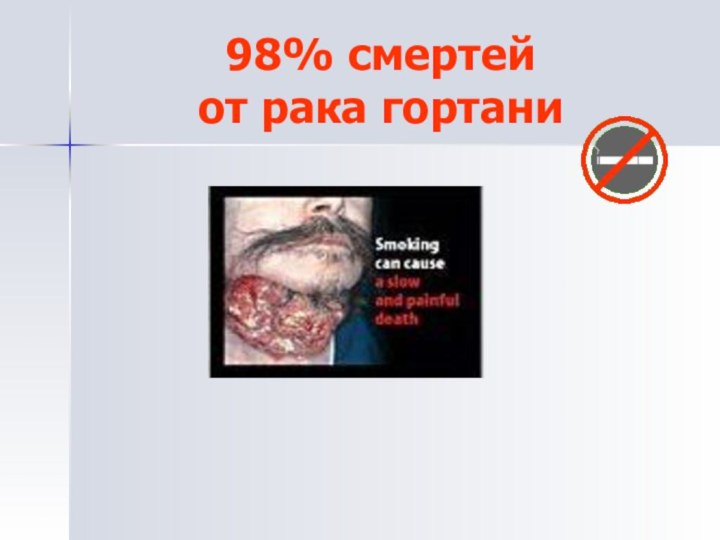 98% смертей  от рака гортани