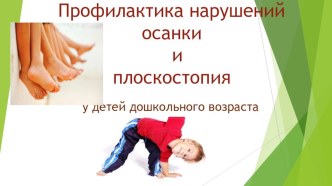 Профилактика нарушений осанки и плоскостопия у детей дошкольного возраста. консультация